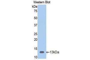 Western Blotting (WB) image for anti-Vitamin D-Binding Protein (GC) (AA 395-475) antibody (ABIN1078668) (Vitamin D-Binding Protein 抗体  (AA 395-475))