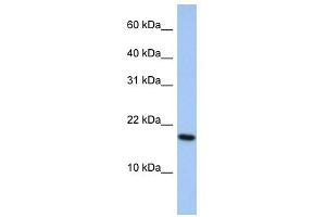 WB Suggested Anti-ARL5A Antibody Titration: 0. (ARL5A 抗体  (Middle Region))