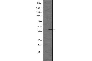 Western blot analysis of CMKLR1 expression in HL60 cell lysate ;,The lane on the left is treated with the antigen-specific peptide. (CMKLR1 抗体  (Internal Region))