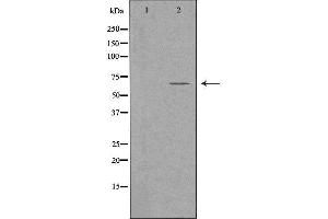Western blot analysis of extracts from Jurkat cells, using FZD9 antibody.