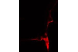 ABIN6269003 staining HeLa cells by IF/ICC. (COL3A1 抗体  (N-Term))