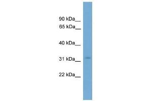 Western Blot showing KRCC1 antibody used at a concentration of 1-2 ug/ml to detect its target protein. (KRCC1 抗体  (N-Term))