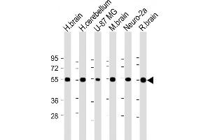 All lanes : Anti-NRXN1 Antibody (N-term) at 1:2000 dilution Lane 1: Human brain lysate Lane 2: Human cerebellum lysate Lane 3: U-87 MG whole cell lysate Lane 4: Mouse brain lysate Lane 5: Neuro-2a whole cell lysate Lane 6: Rat brain lysate Lysates/proteins at 20 μg per lane. (Neurexin 1 抗体  (N-Term))