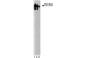 Western blot analysis of Ki-67 on a HeLa lysate (ABIN968535). (Ki-67 抗体  (AA 1547-1742))