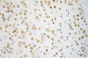 Immunohistochemistry was performed on paraffin-embedded mouse brain using chromodomain helicase DNA binding protein 3 antibody (ABIN7798068), 1:200). (Recombinant CHD3 抗体)