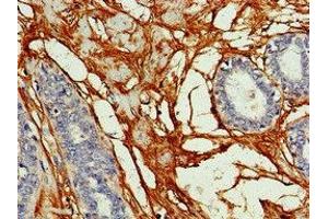 Immunohistochemistry (IHC) image for anti-Gap Junction Protein, alpha 8, 50kDa (GJA8) (AA 286-432) antibody (ABIN7153601)