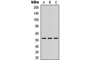 Western blot analysis of DMRTA1 expression in HEK293T (A), Raw264. (DMRTA1 抗体  (Center))