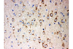 Immunohistochemistry (IHC) image for anti-SRY (Sex Determining Region Y)-Box 2 (SOX2) (AA 171-183), (Middle Region) antibody (ABIN3044477)