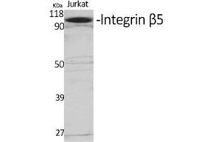 Western Blot analysis of various cells using Integrin β5 Polyclonal Antibody diluted at 1:1000. (Integrin beta 5 抗体  (AA 690-770))