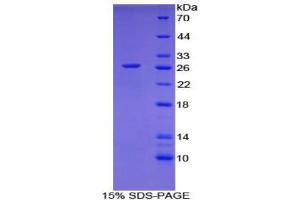 SDS-PAGE (SDS) image for CD302 (CD302) (AA 21-225) protein (His tag) (ABIN1879496) (DCL1 Protein (AA 21-225) (His tag))