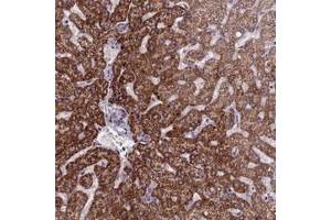 Immunohistochemical staining of human liver with FBRS polyclonal antibody  shows strong cytoplasmic positivity in hepatocytes at 1:20-1:50 dilution. (Fibrosin 抗体)