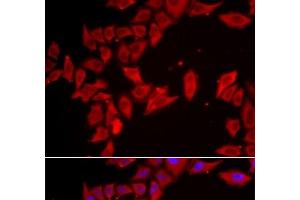 Immunofluorescence analysis of HeLa cells using SLC35A2 Polyclonal Antibody (SLC35A2 抗体)