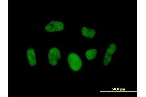 Immunofluorescence of  purified  MaxPab antibody to BRD3 on HeLa cell. (BRD3 抗体  (AA 1-556))