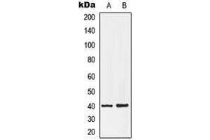 Western blot analysis of EDG7 expression in HepG2 (A), NT2D1 (B) whole cell lysates. (LPAR3 抗体  (C-Term))