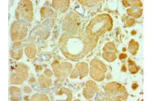 Immunohistochemistry of paraffin-embedded human pancreatic tissue using ABIN7143956 at dilution of 1:100 (ALS2 抗体  (AA 1-280))