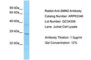 Image no. 1 for anti-SMN1 / SMN2 (AA 51-100) antibody (ABIN6749971) (SMN1 / SMN2 (AA 51-100) 抗体)