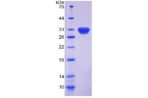 SDS-PAGE (SDS) image for Dyskeratosis Congenita 1, Dyskerin (DKC1) (AA 298-509) protein (His tag) (ABIN4989257)
