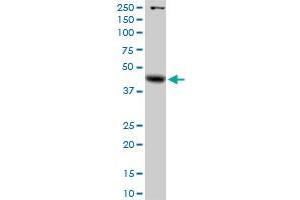 GLA MaxPab rabbit polyclonal antibody. (GLA 抗体  (AA 1-429))