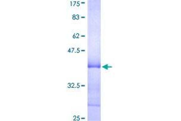 TRIM63 Protein (AA 254-352) (GST tag)