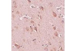 Immunohistochemistry of FAM59B in human brain tissue with FAM59B antibody at 5 μg/ml. (FAM59B 抗体  (C-Term))