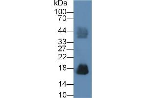 Detection of RNASE2 in Human Urine using Polyclonal Antibody to Ribonuclease A2 (RNASE2) (RNASE2 抗体  (AA 28-161))