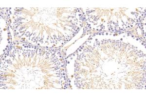 Detection of SAP in Rat Testis Tissue using Polyclonal Antibody to Serum Amyloid P Component (SAP) (APCS 抗体  (AA 22-222))