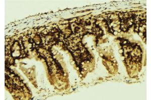 ABIN6267292 at 1/100 staining Mouse colon tissue by IHC-P. (p53 抗体  (pSer366))