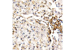 Immunohistochemistry of paraffin-embedded human liver using FBN1 Rabbit pAb (ABIN7267176) at dilution of 1:50 (40x lens). (Fibrillin 1 抗体  (AA 360-460))