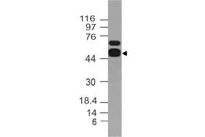 Image no. 1 for anti-Aldehyde Dehydrogenase 1 Family, Member A1 (ALDH1A1) (AA 300-500) antibody (ABIN5027482) (ALDH1A1 抗体  (AA 300-500))