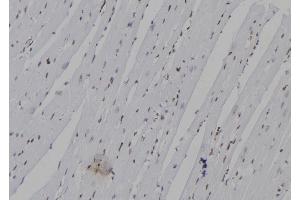 ABIN6277336 at 1/100 staining Mouse heart tissue by IHC-P.