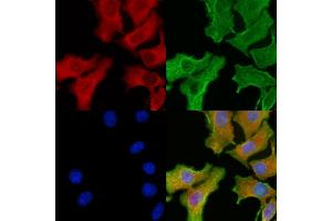 ABIN6260629 and ABIN6276912 staining Hela cells by IF/ICC. (CD47 抗体  (C-Term))