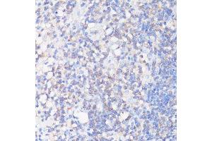 Immunohistochemistry of paraffin-embedded human appendix using CFL1 antibody. (Cofilin 抗体  (AA 1-100))