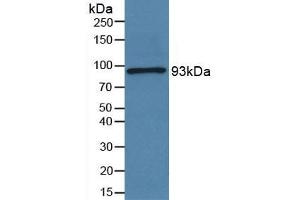 Rabbit Capture antibody from the kit in WB with Positive Control: Sample Human serum. (Periostin ELISA 试剂盒)