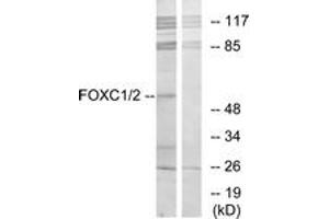 Western blot analysis of extracts from RAW264. (FOXC1 抗体  (AA 151-200))