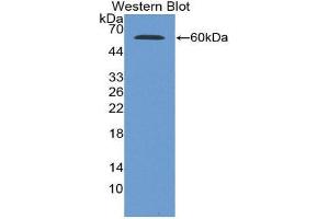 Western Blotting (WB) image for anti-Glucose-6-Phosphate Dehydrogenase (G6PD) (AA 1-515) antibody (ABIN3210120) (Glucose-6-Phosphate Dehydrogenase 抗体  (AA 1-515))