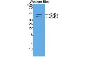 Western blot analysis of recombinant Human IGFBP1. (IGFBPI 抗体  (AA 159-249))