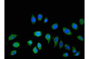 Immunofluorescence (IF) image for anti-ATPase, H+ Transporting, Lysosomal 42kDa, V1 Subunit C2 (ATP6V1C2) (AA 190-262) antibody (ABIN7175236)