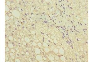 Immunohistochemistry of paraffin-embedded human liver tissue using ABIN7154045 at dilution of 1:100 (GATC 抗体  (AA 1-136))