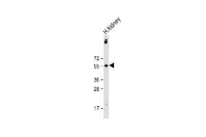 Anti-UGT1A9 Antibody (C-Term) at 1:2000 dilution + human kidney lysate Lysates/proteins at 20 μg per lane.