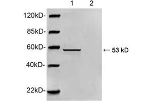 Western blot analysis of HEK293 cell lysate using 1 µg/mL Rabbit Anti-Vimentin Polyclonal Antibody (ABIN398717) Primary Antibody: Lane 1: Rabbit Anti-Vimentin Polyclonal AntibodyLane 2: Rabbit Anti-Vimentin Polyclonal Antibody pre-incubated with immunizing peptideThe signal was developed with IRDyeTM 800 Conjugated Goat Anti-Rabbit IgG (Vimentin 抗体  (AA 70-120))