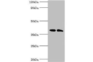 Western blot All lanes: Casein kinase I isoform alpha-like antibody at 4 μg/mL Lane 1: K562 whole cell lysate Lane 2: Hela whole cell lysate Secondary Goat polyclonal to rabbit IgG at 1/10000 dilution Predicted band size: 39 kDa Observed band size: 39 kDa (CSNK1A1L 抗体  (Isoform alpha))