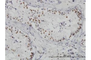 Immunoperoxidase of monoclonal antibody to HDAC1 on formalin-fixed paraffin-embedded human testis. (HDAC1 抗体  (AA 1-482))