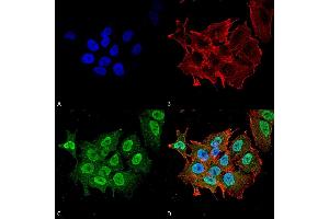 Immunocytochemistry/Immunofluorescence analysis using Mouse Anti-Ataxin 1 Monoclonal Antibody, Clone S76-8 . (Ataxin 1 抗体  (AA 164-197) (FITC))