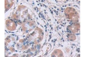 Detection of IL12A in Human Stomach Tissue using Monoclonal Antibody to Interleukin 12A (IL12A) (IL12A 抗体  (AA 23-219))