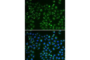 Immunofluorescence analysis of A549 cell using GPX4 antibody. (GPX4 抗体  (AA 30-197))