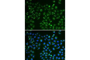 Immunofluorescence analysis of A549 cell using GPX4 antibody. (GPX4 抗体  (AA 30-197))
