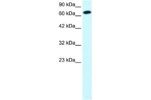 Western Blotting (WB) image for anti-Signal Transducer and Activator of Transcription 4 (STAT4) (N-Term) antibody (ABIN2777897)