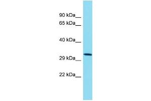 Host: Rabbit Target Name: TMEM241 Sample Type: NCI-H226 Whole Cell lysates Antibody Dilution: 1. (TMEM241 抗体  (C-Term))