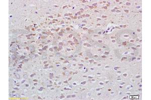 Formalin-fixed and paraffin embedded rat brain tissue labeled with Anti-Tubulin-alpha Polyclonal Antibody, Unconjugated (ABIN725630) at 1:200, followed by conjugation to the secondary antibody and DAB staining (alpha Tubulin 抗体  (AA 375-448))