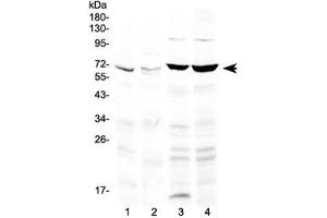 Western blot testing of 1) rat lung, 2) mouse lung, 3) human A549 and 4) human HeLa lysate with PPAR gamma antibody at 0.